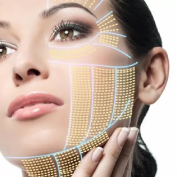 Hifu Facial: Lifting no quirúrgico