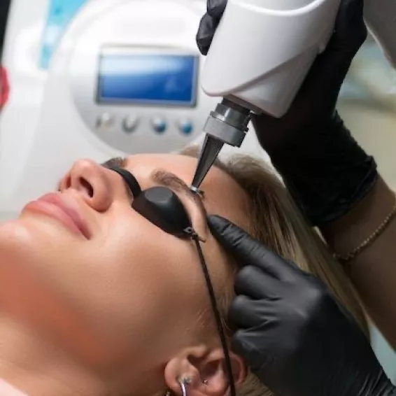 Eliminación de tatuajes:   láser Q-Switched y Removal para decir adiós a los tatuajes no deseados"